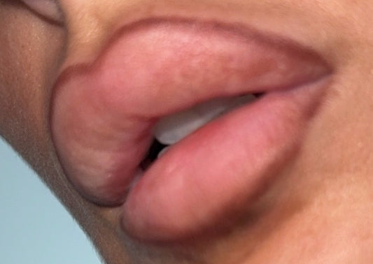 Rim